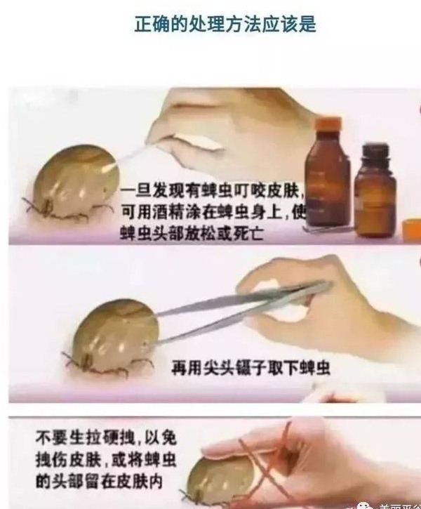 深圳殺蟲(chóng)公司怎樣快速去除跳蚤和蜱蟲(chóng)等寄生蟲(chóng)？_6 (9).jpeg