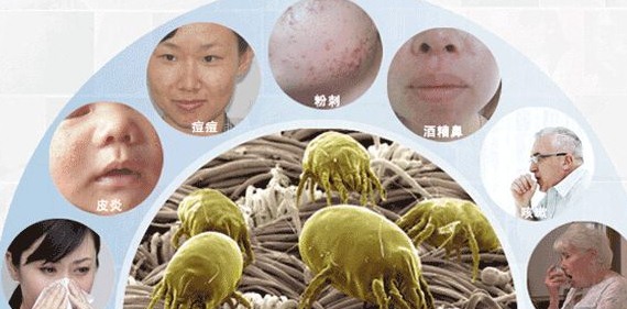 深圳殺蟲(chóng)公司如何滅螨蟲(chóng)除四害 (86).jpeg